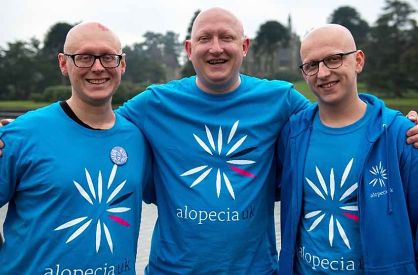 Three men with alopecia smiling 