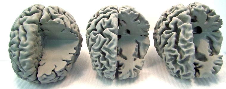 Three models of the human brain.