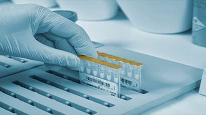 A human hand wearing a medical glove taking out a sample in a laboratory.