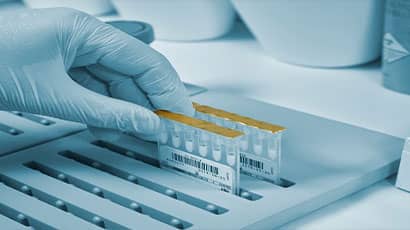 A human hand wearing a medical glove taking out a sample in a laboratory.
