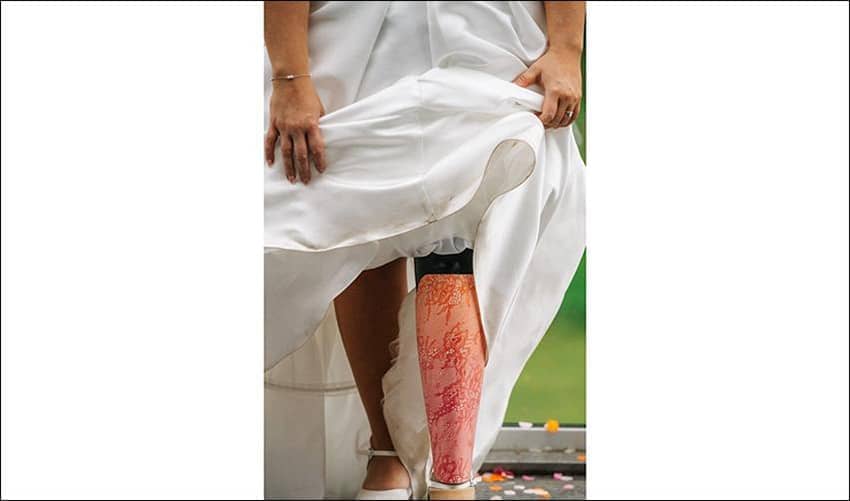 Image of a person in a white wedding dress holding up their dress to reveal a pink leg covering on their shin