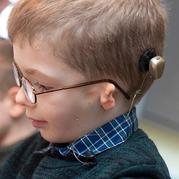 Little boy with a craniofacial condition