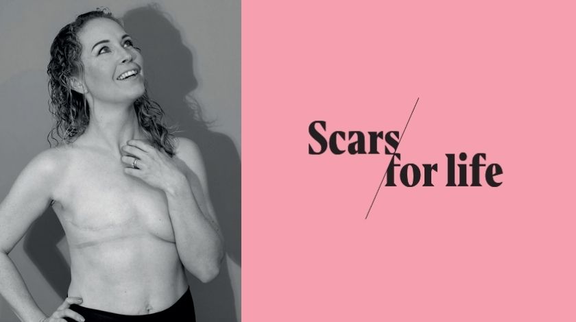 Scars for life model in black and white with scars for life logo